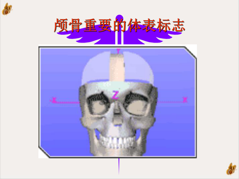 神经外科手术定位课件.pptx_第2页