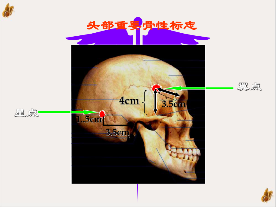 神经外科手术定位课件.pptx_第3页