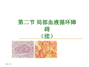 病理学二课件.ppt