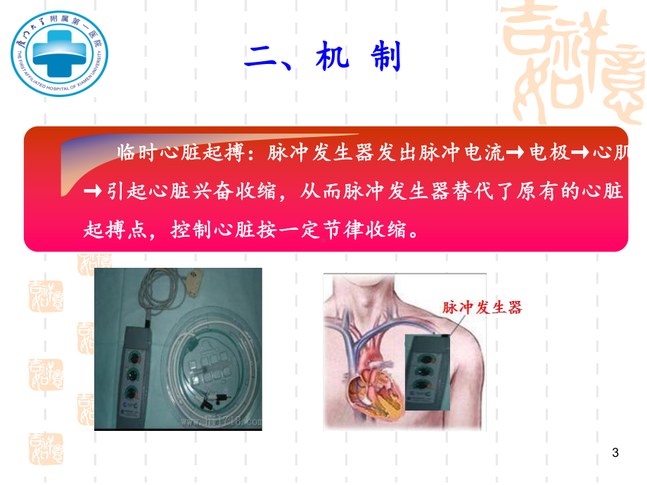 紧急床边心脏起搏术及护理课件.ppt_第3页