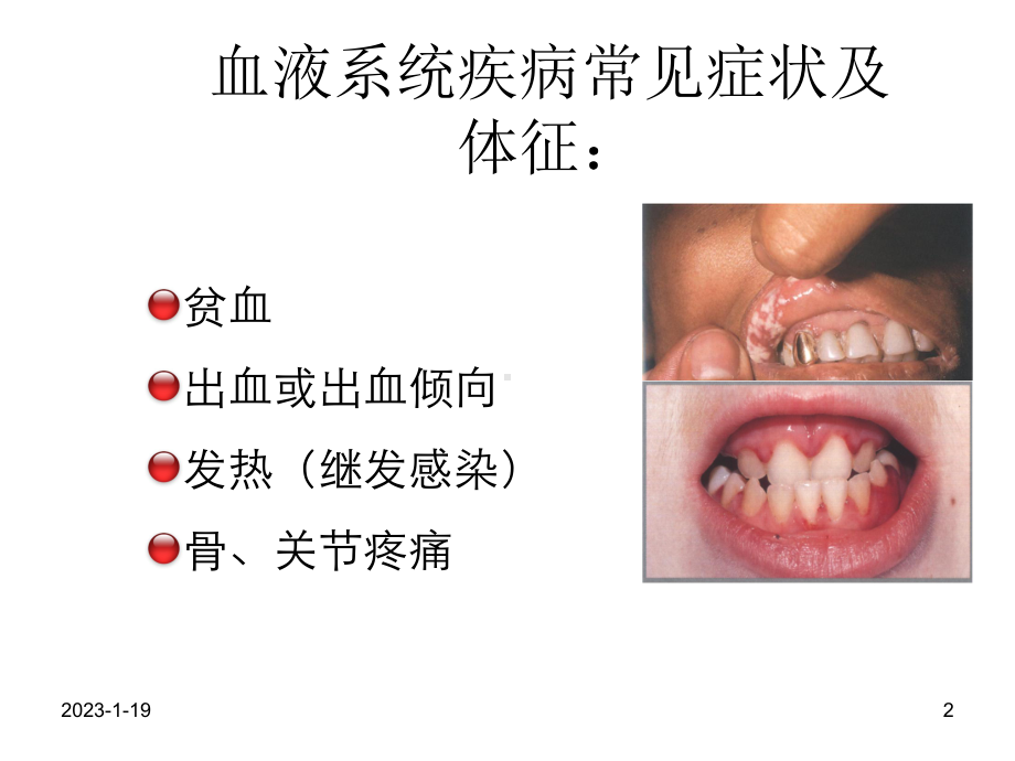 血液科疾病常见症状护理课件整理.ppt_第2页