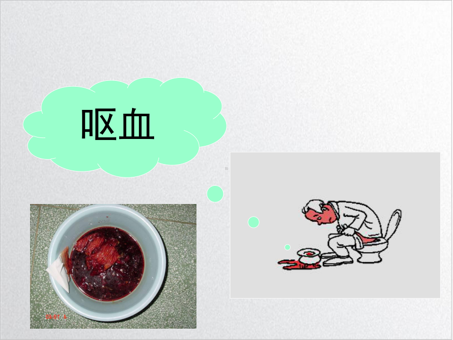 第篇呕血腹痛与黄疸课件.ppt_第3页