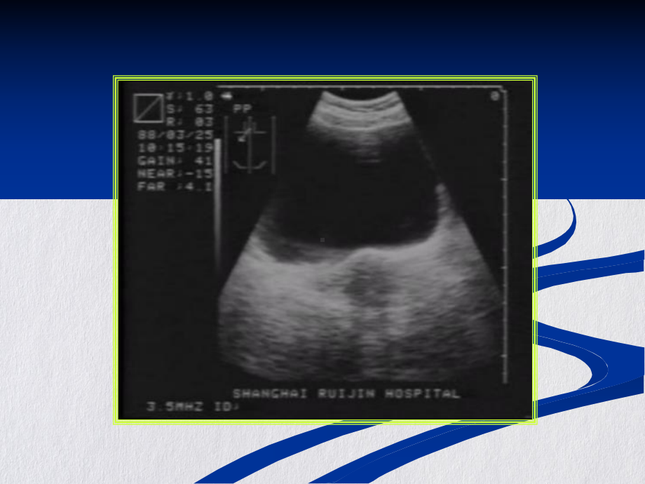 盆腔超声学课件.pptx_第3页