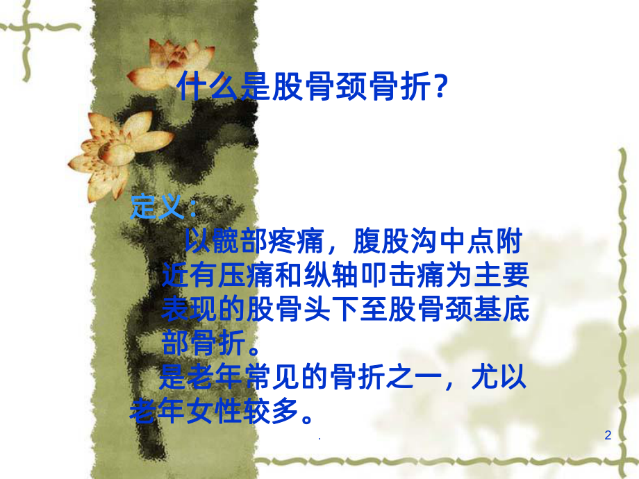 股骨颈骨折的护理课件整理.ppt_第2页