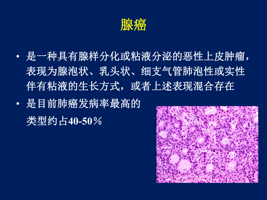 经典：肺癌新分类与分子靶点课件.ppt_第3页