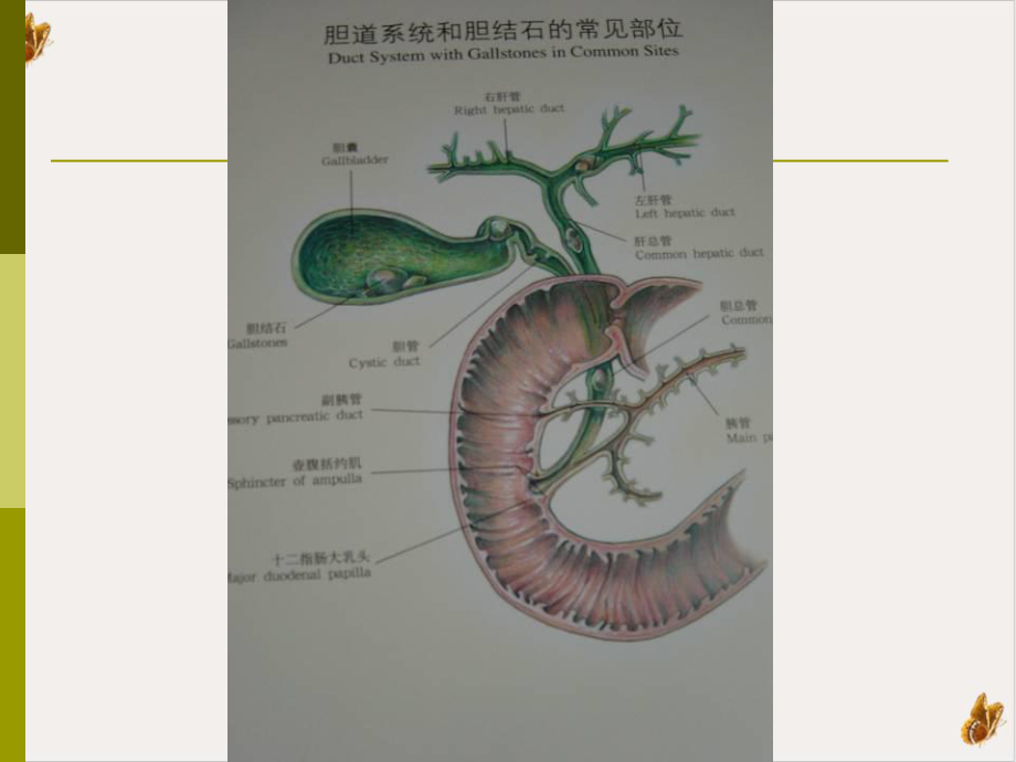 胆囊结石成因和治疗进展教材课件.pptx_第1页