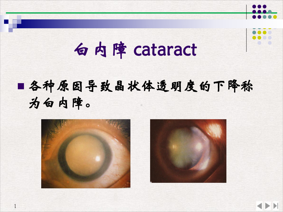 白内障青光眼公开课课件.pptx_第1页