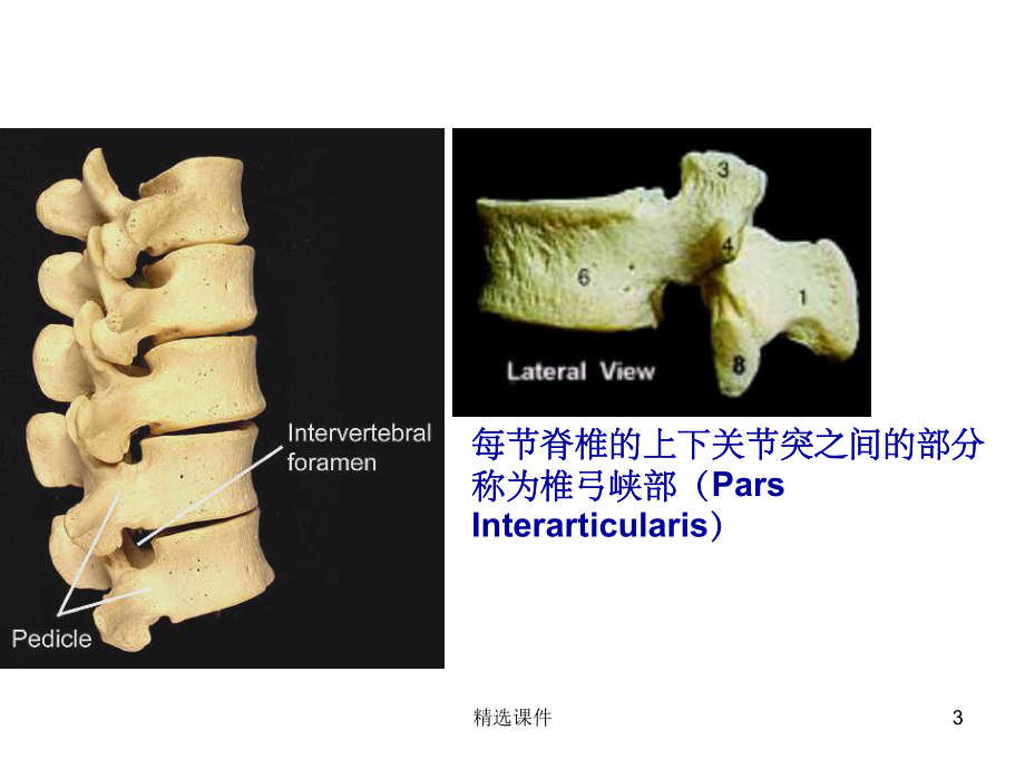 腰椎的解剖及腰部的层次解剖课件(同名1289).ppt_第3页