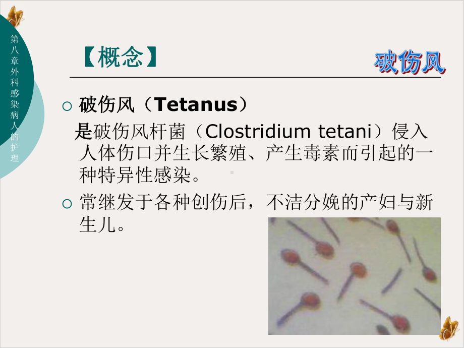 破伤风病人的护理课件(同名54).pptx_第2页