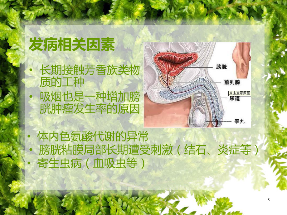 膀胱癌护理查房课件.pptx_第3页