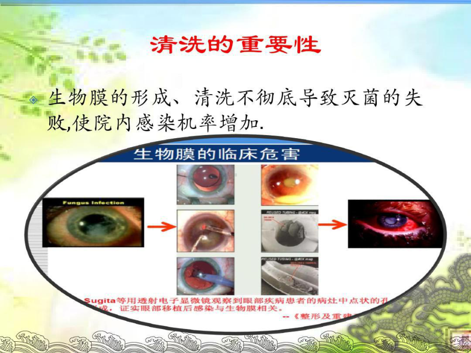 眼科显微器械的清洗流程课件.ppt_第3页