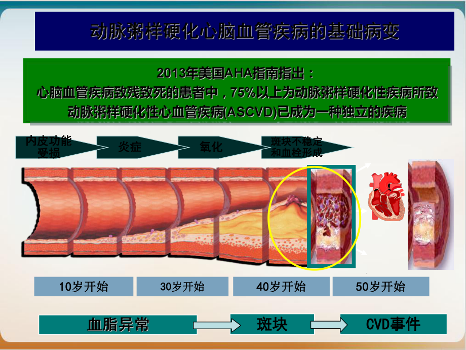 血脂异常的危险分层与治疗示范课件.ppt_第3页