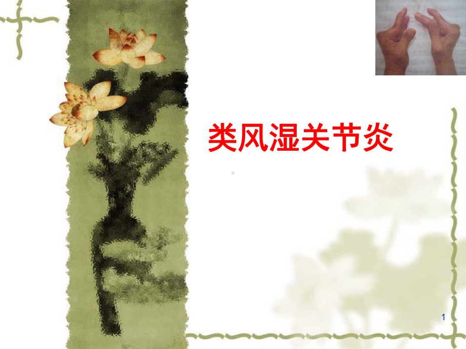 类风湿关节炎课件(同名40).ppt_第1页