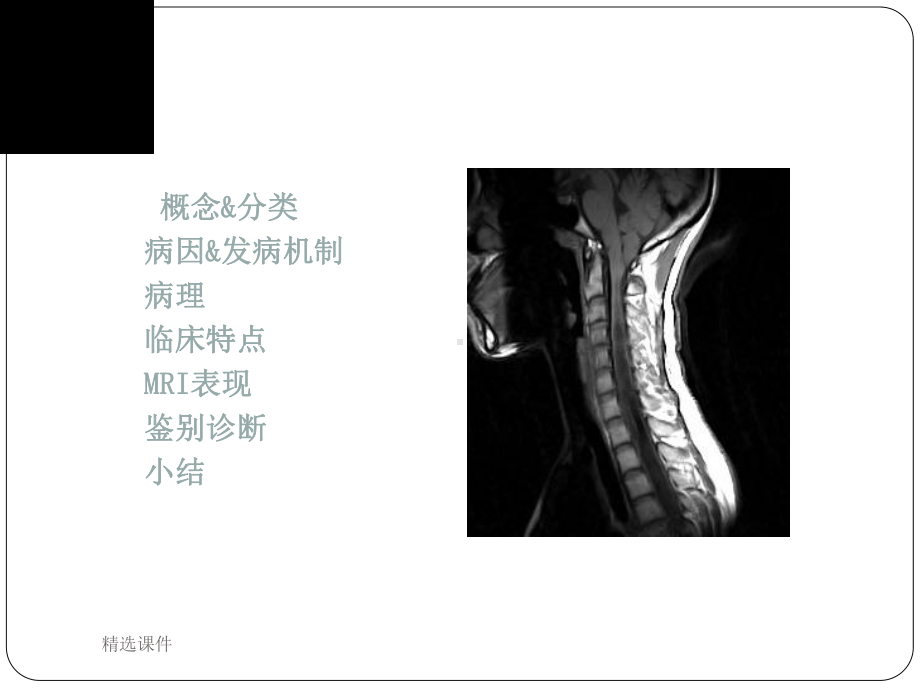 脊髓空洞症MRI表现课件整理.ppt_第2页