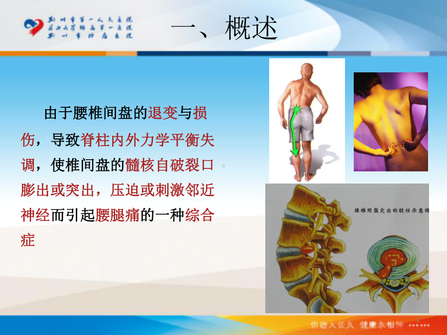 硬膜外注射治疗腰椎间盘突出症课件.ppt_第2页