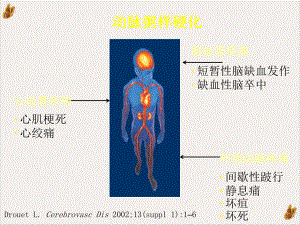 社区心血管疾病的早期发现与转诊课件整理.pptx