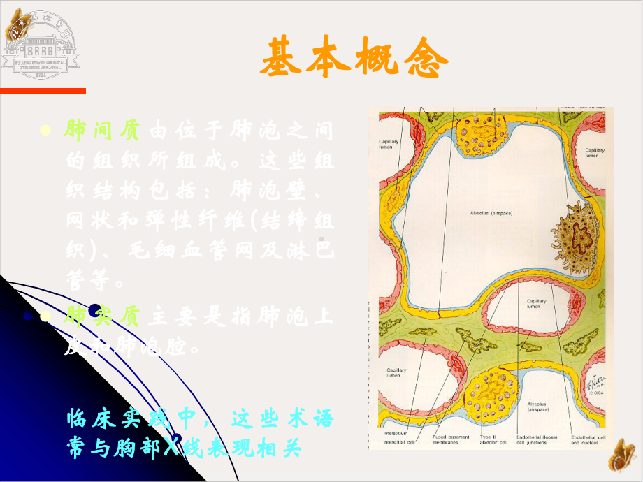 间质性肺病课件.pptx_第2页