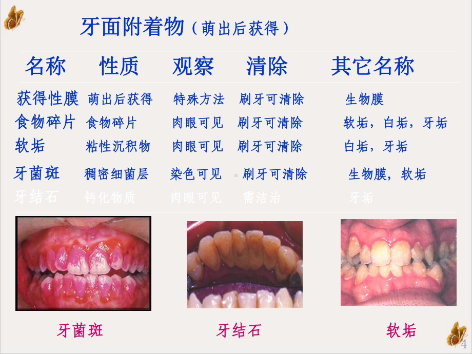 龋病病因及发病过程课件.pptx_第3页