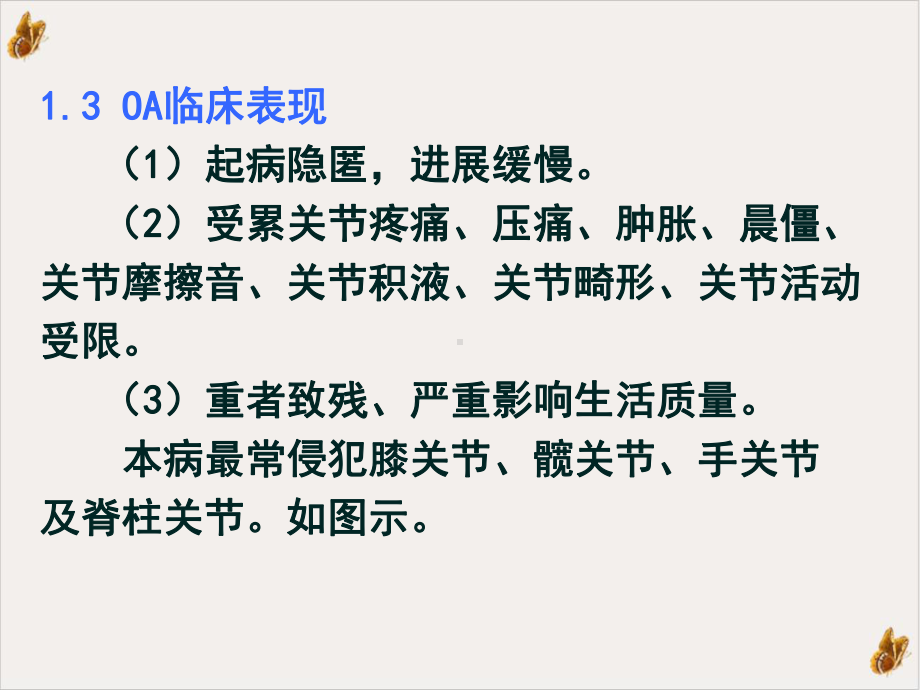 骨关节炎发病机制研究进展实用课件.pptx_第3页