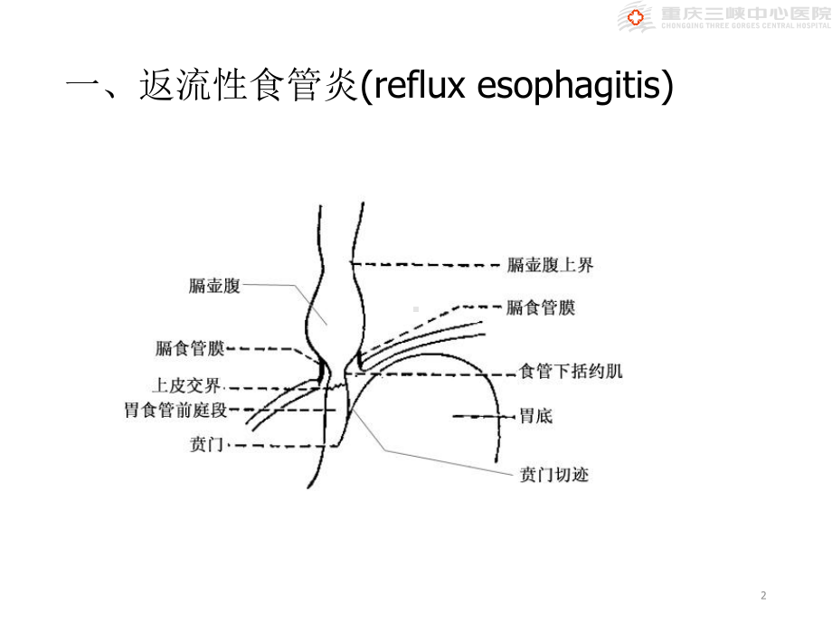 食管及贲门疾病食管炎课件.ppt_第2页