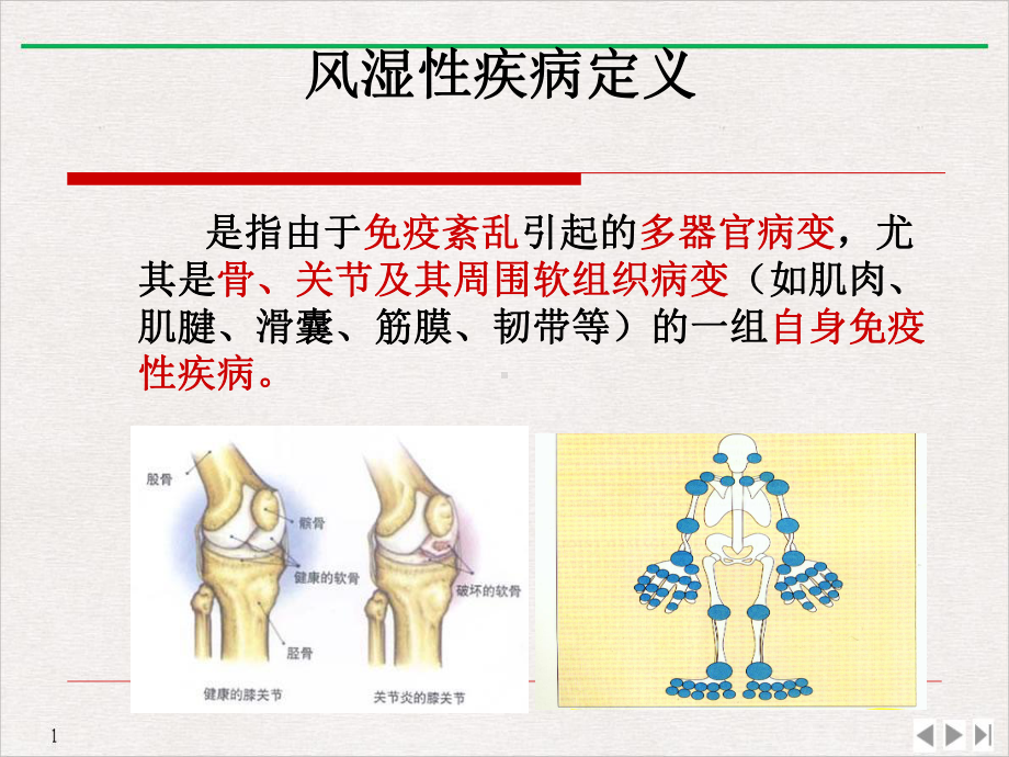 风湿性疾病病人的护理教学课件.pptx_第3页