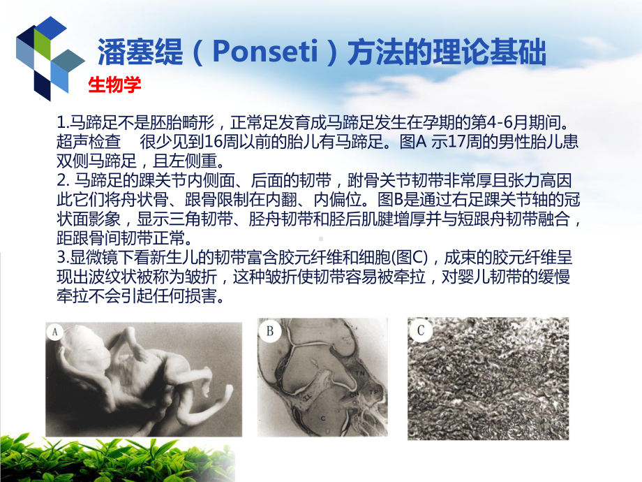 马蹄内翻足治疗法课件.pptx_第2页