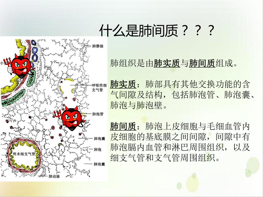 间质性肺炎护理查房课件整理.ppt_第3页