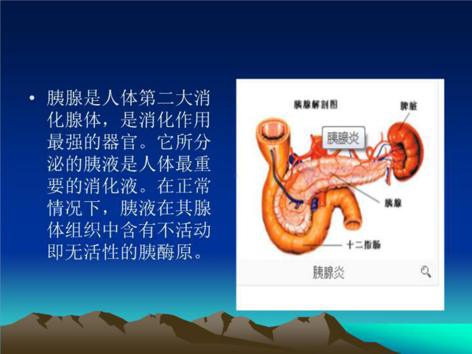 最新6月急性胰腺炎的护理课件.ppt_第3页