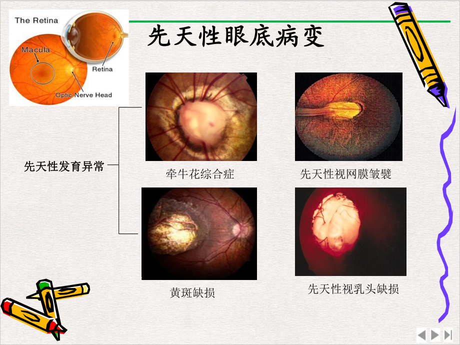 近视眼的防控课件.pptx_第2页