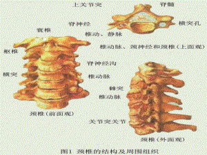 颈椎X线诊断修课件.pptx