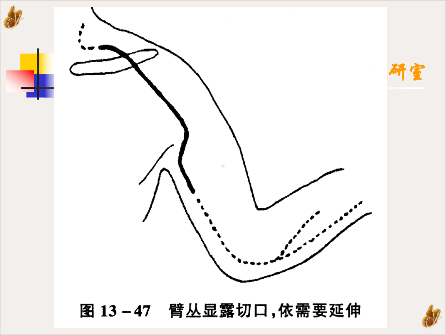 骨科手术的解剖基础手术显露神经血管教材课件.pptx_第1页