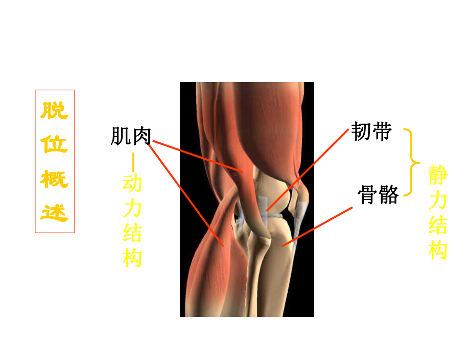 骨伤学护理学之关节脱位课件.ppt_第3页