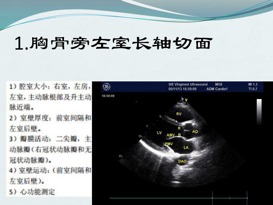 超声心动图规范课件.pptx_第2页