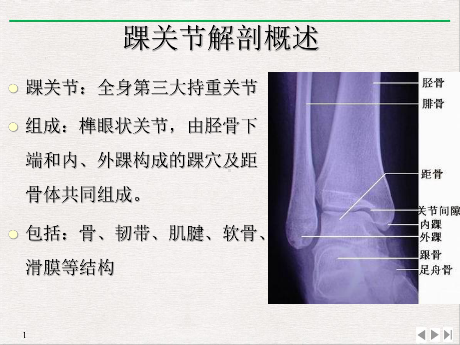 踝关节损伤磁共振诊断课件整理.ppt_第2页