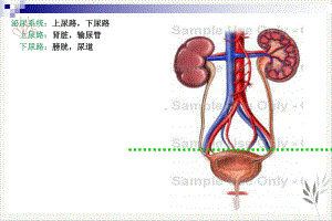 泌尿损伤病人的护理课件.pptx