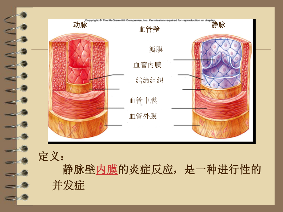 输液性静脉炎研究进展课件.ppt_第2页