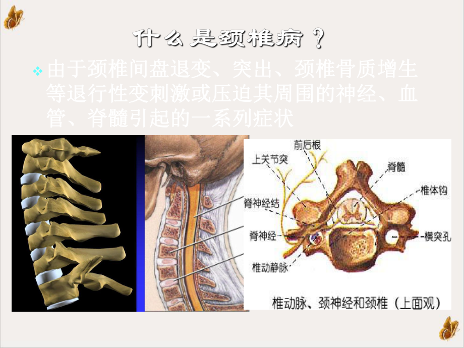 颈椎病分型及治疗培训课程课件.pptx_第1页