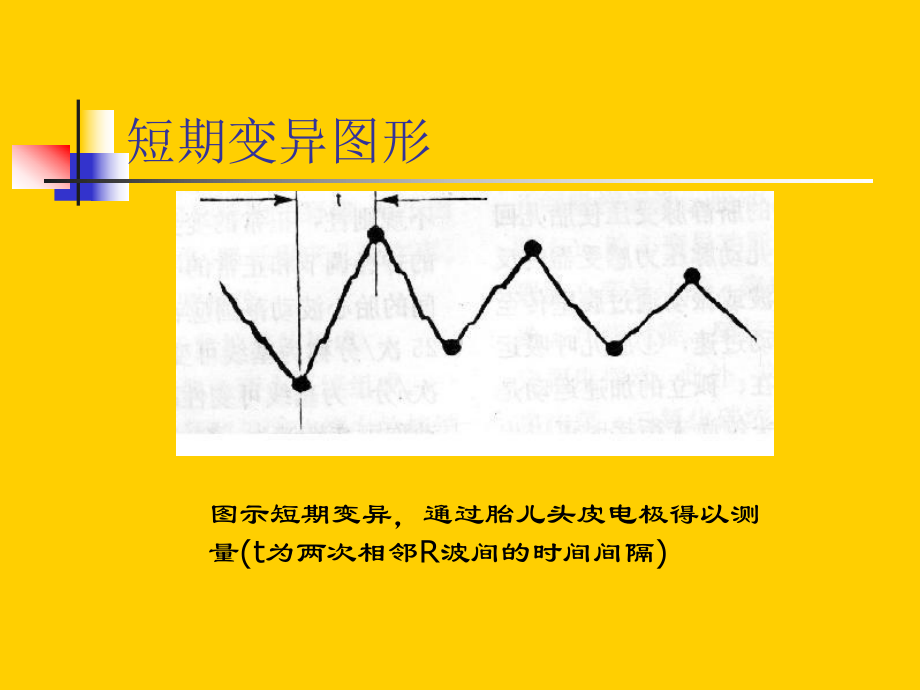 高危妊娠的监护与处理课件.pptx_第2页