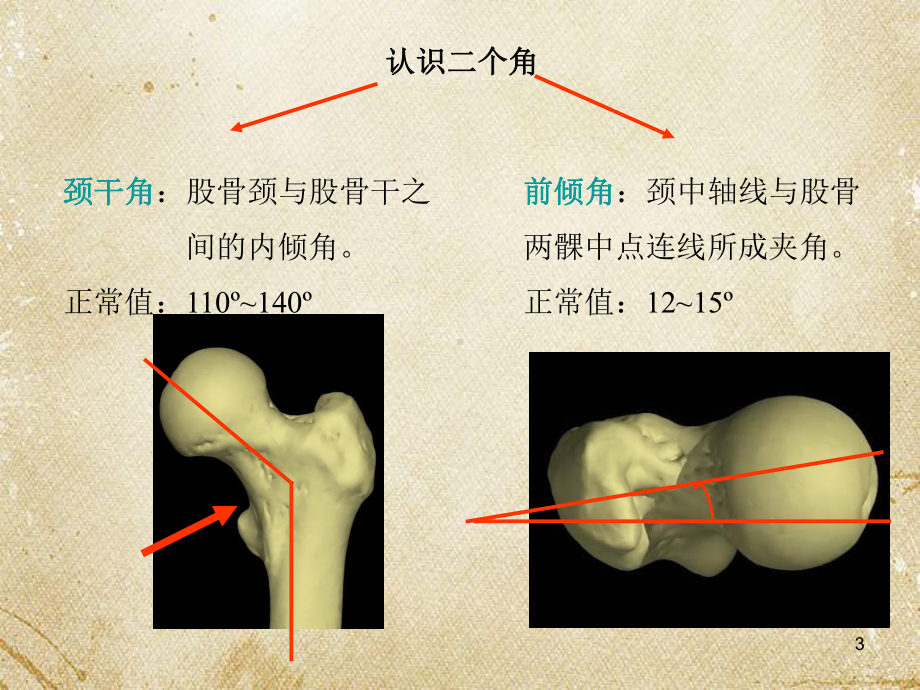 髋关节置换研究课件.ppt_第3页