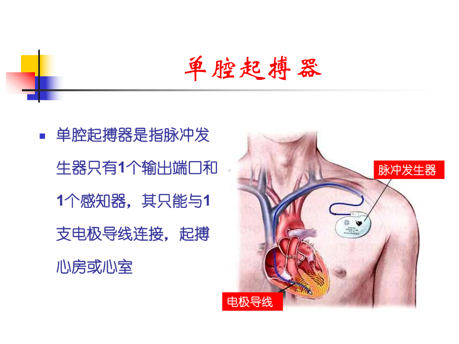 起搏心电图阅读与分析课件.ppt_第2页