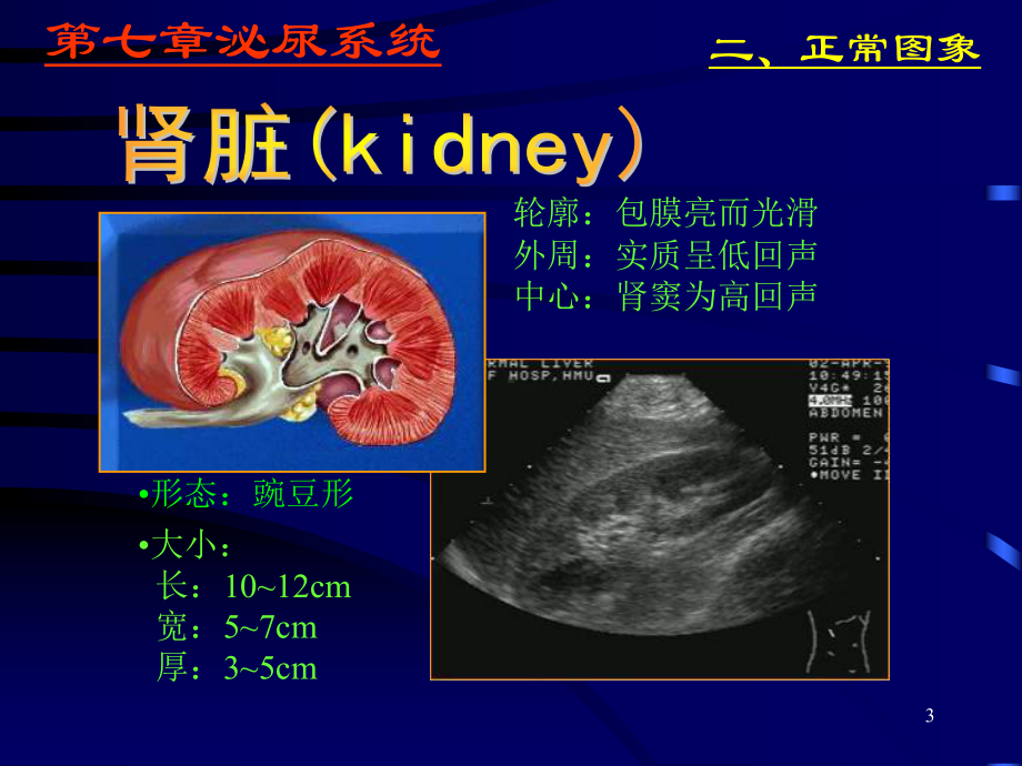 超声诊断学课件(同名165).ppt_第3页