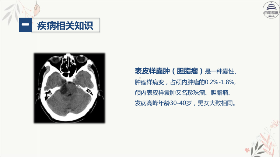 颅内表皮样囊肿患者的护理查房课件.pptx_第3页