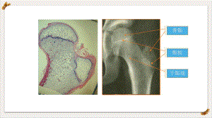 骨骺损伤的影像学表现课件整理.pptx