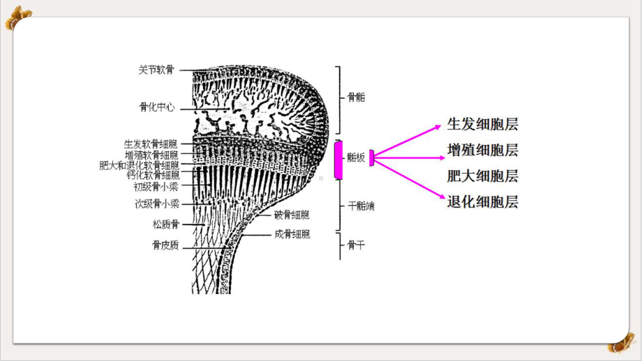 骨骺损伤的影像学表现课件整理.pptx_第3页