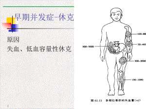 骨折并发症护理课件.pptx