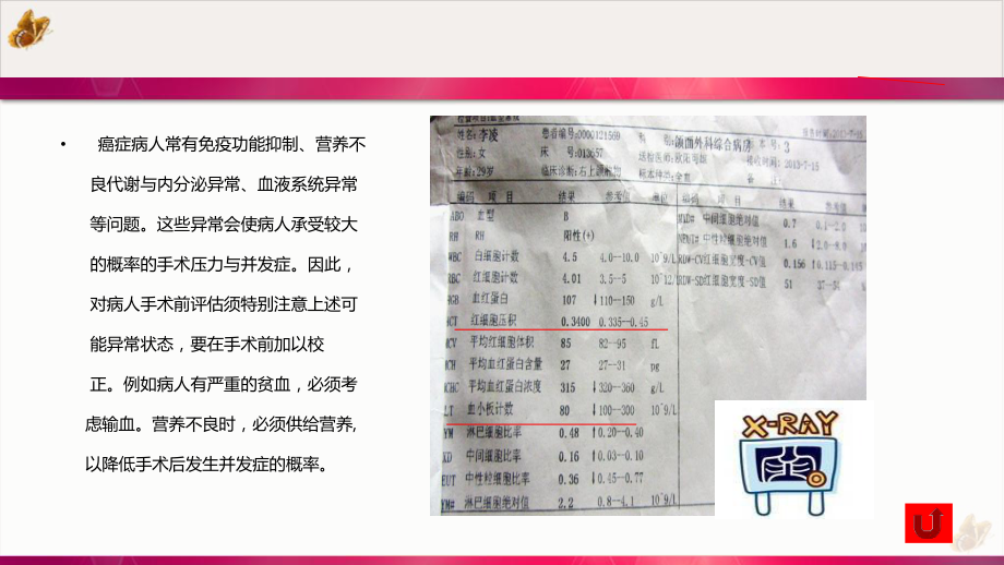 颌面部肿瘤患者的护理实用课件.ppt_第3页