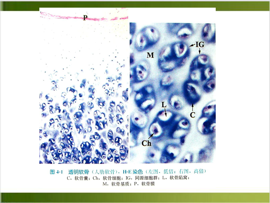 软骨和骨五年制课件.pptx_第3页