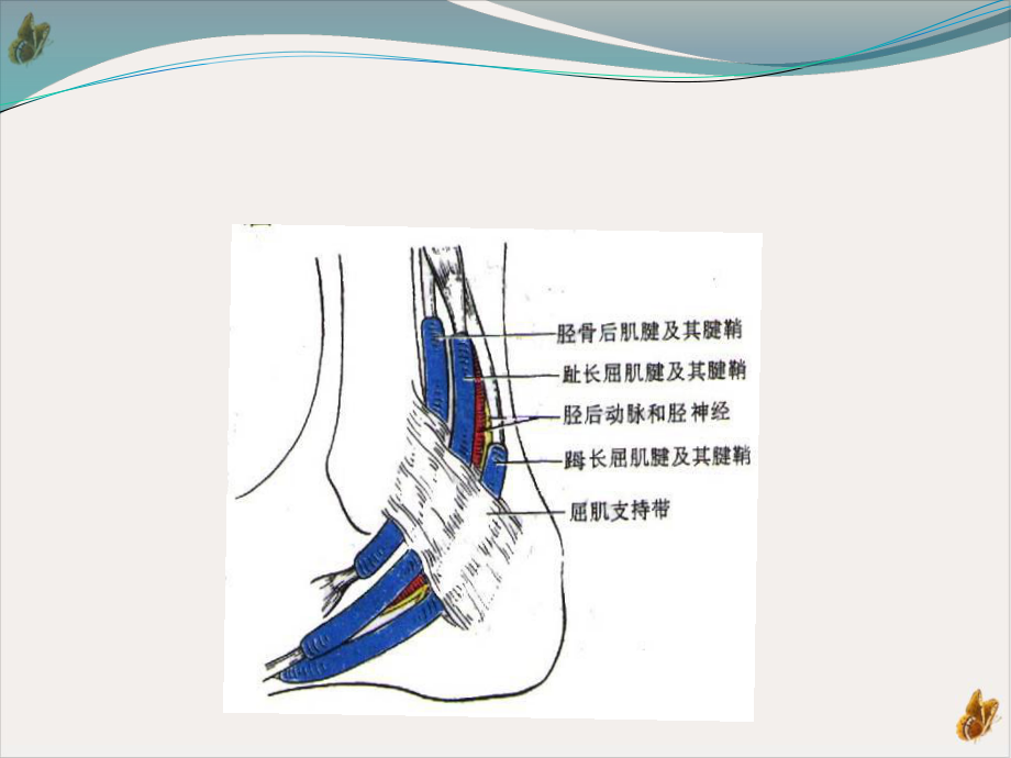 踝管综合症的保守治疗课件.pptx_第3页