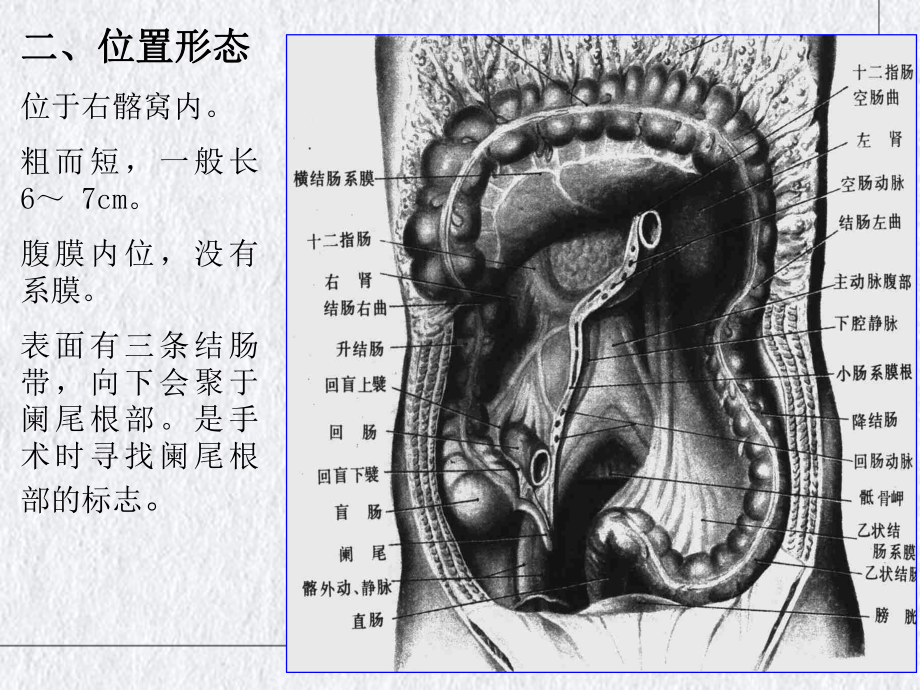 阑尾切除的临床解剖讲课课件.pptx_第2页