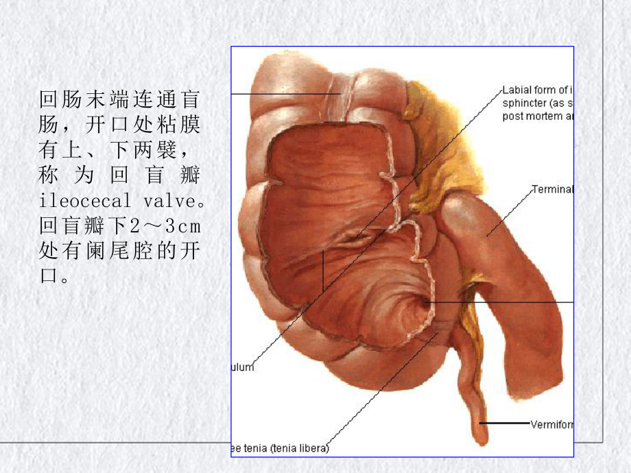 阑尾切除的临床解剖讲课课件.pptx_第3页